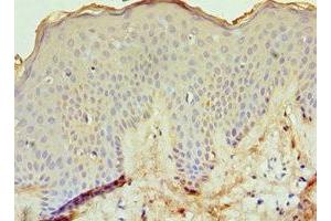 Immunohistochemistry of paraffin-embedded human skin tissue using ABIN7151764 at dilution of 1:100 (ECE1 anticorps  (AA 471-770))