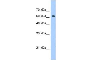 WB Suggested Anti-ZNF675 Antibody Titration:  1. (ZNF675 anticorps  (C-Term))