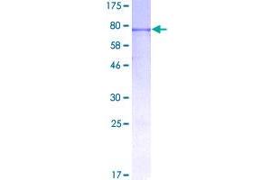 Image no. 1 for Inhibin, beta A (INHBA) (AA 1-426) protein (GST tag) (ABIN1307932)