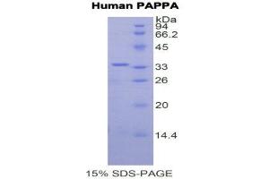 SDS-PAGE (SDS) image for Pregnancy-Associated Plasma Protein A, Pappalysin 1 (PAPPA) (AA 1270-1558) protein (His tag) (ABIN2121932) (PAPPA Protein (AA 1270-1558) (His tag))