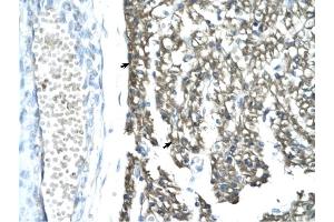 MORF4L1 antibody was used for immunohistochemistry at a concentration of 4-8 ug/ml to stain Myocardial cells (arrows) in Human Heart. (MORF4L1 anticorps  (Middle Region))