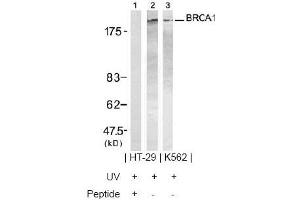 Image no. 2 for anti-Breast Cancer 1 (BRCA1) (Ser1423) antibody (ABIN197480) (BRCA1 anticorps  (Ser1423))