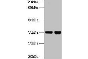 Western blot All lanes: ZBED1 antibody at 2 μg/mL Lane 1: EC109 whole cell lysate Lane 2: 293T whole cell lysate Secondary Goat polyclonal to rabbit IgG at 1/15000 dilution Predicted band size: 79 kDa Observed band size: 35 kDa