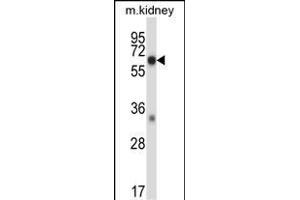 Mouse Map3k2 Antibody (N-term) (ABIN657838 and ABIN2846800) western blot analysis in mouse kidney tissue lysates (35 μg/lane). (MAP3K2 anticorps  (N-Term))
