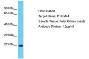 Image no. 1 for anti-Chromosome 12 Open Reading Frame 44 (C12orf44) (AA 29-78) antibody (ABIN6750653) (ATG101 anticorps  (AA 29-78))