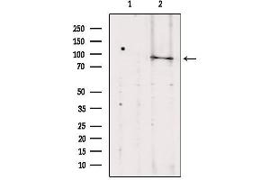 Western blot analysis of extracts from Hela, using TELO2 antibody. (TELO2 anticorps  (Internal Region))