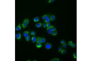 Image no. 1 for anti-Interferon-Induced Protein with Tetratricopeptide Repeats 1 (IFIT1) antibody (ABIN1498803)