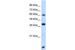 Host:  Rabbit  Target Name:  RFX4  Sample Type:  Transfected 293T Whole Cell lysates  Antibody Dilution:  1. (RFX4 anticorps  (N-Term))