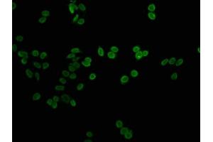 Immunofluorescence staining of HepG2 cells with nme1HU at 1:1, counter-stained with DAPI. (Histone H1 anticorps)