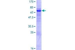 Image no. 1 for SET Domain and Mariner Transposase Fusion Gene (SETMAR) (AA 1-352) protein (GST tag) (ABIN1319691)