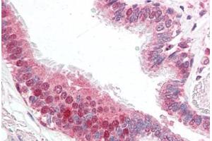 Human Lung (formalin-fixed, paraffin-embedded) stained with CFLAR antibody ABIN461877 at 5 ug/ml followed by biotinylated goat anti-rabbit IgG secondary antibody ABIN481713, alkaline phosphatase-streptavidin and chromogen.