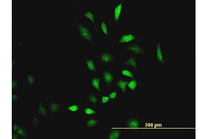 Immunofluorescence of monoclonal antibody to CBS on HeLa cell. (CBS anticorps  (AA 1-100))