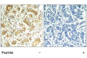 Image no. 1 for anti-Spleen tyrosine Kinase (SYK) (AA 321-325) antibody (ABIN319416) (SYK anticorps  (AA 321-325))