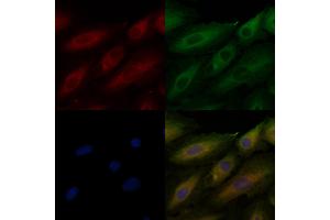 ABIN6260576 and ABIN6276962 staining  cells by IF/ICC. (CD151 anticorps  (N-Term))