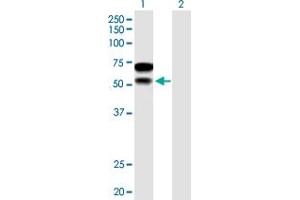 Western Blot analysis of CHD2 expression in transfected 293T cell line by CHD2 MaxPab polyclonal antibody. (CHD2 anticorps  (AA 1-501))