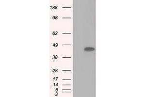 Image no. 7 for anti-Acetyl-CoA Acetyltransferase 2 (ACAT2) antibody (ABIN1496400) (ACAT2 anticorps)