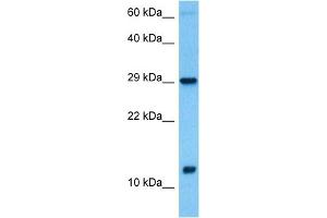Host:  Rabbit  Target Name:  MRPS6  Sample Tissue:  Human Testicular Tumor lysates  Antibody Dilution:  1ug/ml (MRPS6 anticorps  (C-Term))