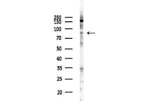 Western blot analysis of lysates from COLO205 cells(UV 30 min treatment), using SLC6 Antibody at 1/1000 dilution.