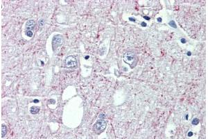 Brain, cortex, Human: Formalin-Fixed, Paraffin-Embedded (FFPE)