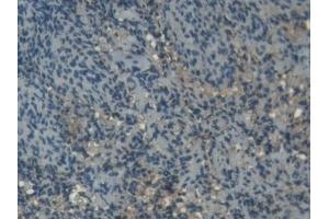 Detection of SOD1 in Porcine Spleen Tissue using Polyclonal Antibody to Superoxide Dismutase 1 (SOD1) (SOD1 anticorps  (AA 2-153))