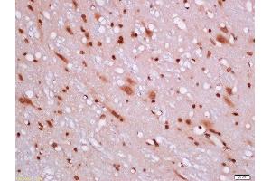Formalin-fixed and paraffin embedded rat brain labeled with Rabbit Anti-BCL2L1 Polyclonal Antibody, Unconjugated 1:200 followed by conjugation to the secondary antibody and DAB staining (BCL2L1 anticorps  (AA 81-200))