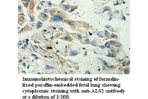 Image no. 1 for anti-Amyotrophic Lateral Sclerosis 2 (Juvenile) (ALS2) antibody (ABIN1574645) (ALS2 anticorps)