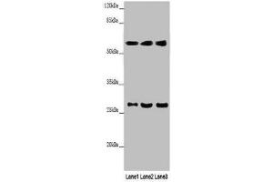 Western blot All lanes: MAOB antibody at 9 μg/mL Lane 1: Mouse liver tissue Lane 2: HepG2 whole cell lysate Lane 3: A549 whole cell lysate Secondary Goat polyclonal to rabbit IgG at 1/10000 dilution Predicted band size: 59, 47 kDa Observed band size: 59, 27 kDa