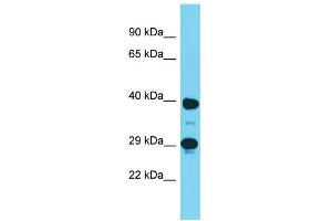 Host:  Rabbit  Target Name:  Dmrtc2  Sample Type:  Mouse Stomach lysates  Antibody Dilution:  1. (DMRTC2 anticorps  (C-Term))