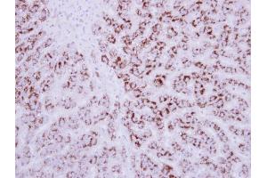 IHC-P Image Immunohistochemical analysis of paraffin-embedded human breast cancer, using EDIL3, antibody at 1:250 dilution. (EDIL3 anticorps  (Center))
