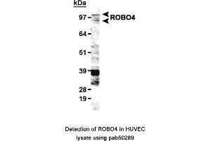 Image no. 1 for anti-Roundabout, Axon Guidance Receptor, Homolog 4 (ROBO4) (AA 900-1007), (C-Term) antibody (ABIN363598) (ROBO4 anticorps  (C-Term))