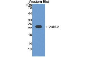 Western Blotting (WB) image for anti-Crystallin, alpha B (CRYAB) (AA 1-175) antibody (ABIN1867399) (CRYAB anticorps  (AA 1-175))