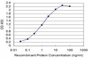 Detection limit for recombinant GST tagged SIX4 is approximately 0. (SIX4 anticorps  (AA 672-780))