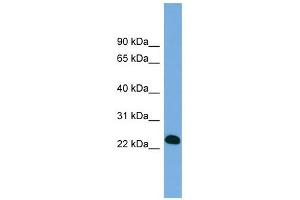 BCL7A antibody used at 1 ug/ml to detect target protein. (BCL7A anticorps  (Middle Region))
