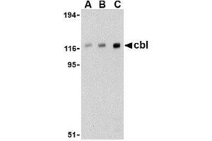 Western blot analysis of cbl in Daudi cell lysate with AP30209PU-N cbl antibody at (A) 0. (CBL anticorps  (C-Term))