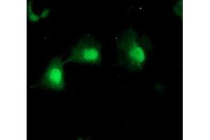 Immunofluorescence (IF) image for anti-Mannose Phosphate Isomerase (MPI) antibody (ABIN1499543)