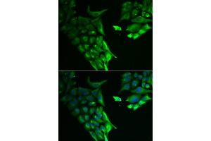 Immunofluorescence analysis of A549 cells using HABP2 antibody. (HABP2 anticorps)