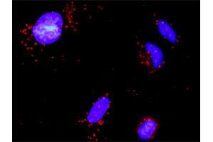 Proximity Ligation Analysis of protein-protein interactions between GSTP1 and MAPK8.