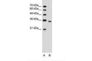 Image no. 1 for anti-phosphoribosyl Pyrophosphate Synthetase 2 (PRPS2) (N-Term) antibody (ABIN203391) (PRPS2 anticorps  (N-Term))
