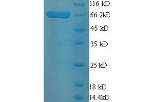 Electron-Transferring-Flavoprotein Dehydrogenase (ETFDH) (AA 34-617) protein (His-SUMO Tag)