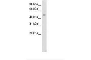Image no. 1 for anti-Jumonji Domain Containing 6 (JMJD6) (AA 296-345) antibody (ABIN202365) (JMJD6 anticorps  (AA 296-345))