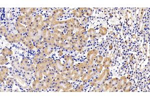 Detection of LIFR in Mouse Kidney Tissue using Polyclonal Antibody to Leukemia Inhibitory Factor Receptor (LIFR) (LIFR anticorps  (AA 151-290))