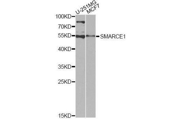 SMARCE1 antibody  (AA 1-411)