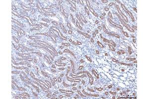 IHC analysis of PAP/ACP3 using anti-PAP/ACP3 antibody (ABIN7600122).