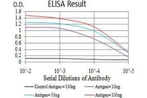 Black line: Control Antigen (100 ng), Purple line: Antigen(10 ng), Blue line: Antigen (50 ng), Red line: Antigen (100 ng),