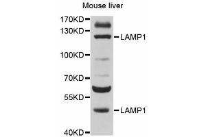 Western blot analysis of extracts of mouse liver, using LAMP1 antibody (ABIN5998110) at 1/500 dilution. (LAMP1 anticorps)