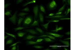 Immunofluorescence of monoclonal antibody to CANX on HeLa cell.
