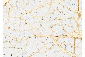 ABIN6262754 and ABIN6279215 at 1/100 staining Rat muscle tissue by IHC-P.