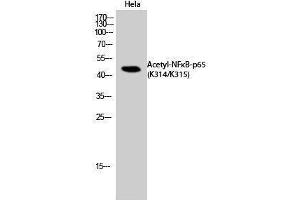 Western Blotting (WB) image for anti-Nuclear Factor-kB p65 (NFkBP65) (acLys314), (acLys315) antibody (ABIN3188030) (NF-kB p65 anticorps  (acLys314, acLys315))