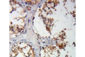 Used in DAB staining on fromalin fixed paraffin-embedded testis tissue (COMP anticorps  (AA 123-240))