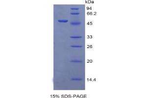 SDS-PAGE analysis of Rat EGFR2 Protein. (EGFR2 Protéine)